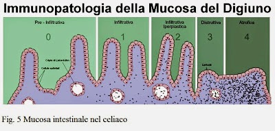 Scopri di più sull'articolo Le intolleranze alimentari